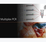 Multiplex PCR - Phát hiện nhanh, chính xác bệnh gan thận mủ