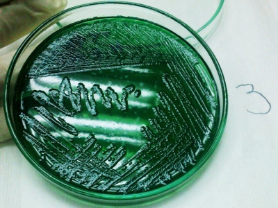 Vibrio diabolicus - Vi khuẩn mới, gây bệnh trên thủy sản